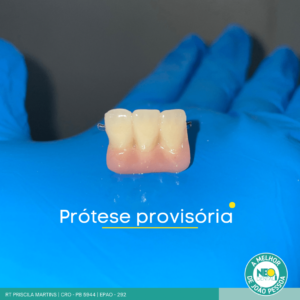 protese-dentaria-7